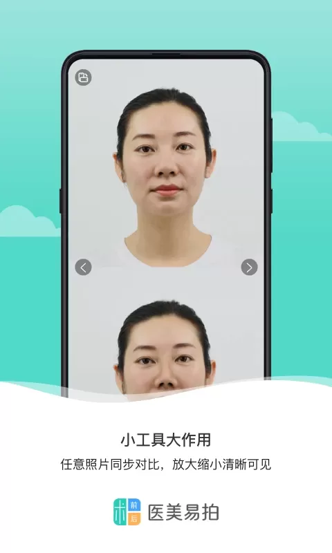 医美易拍安卓版图2