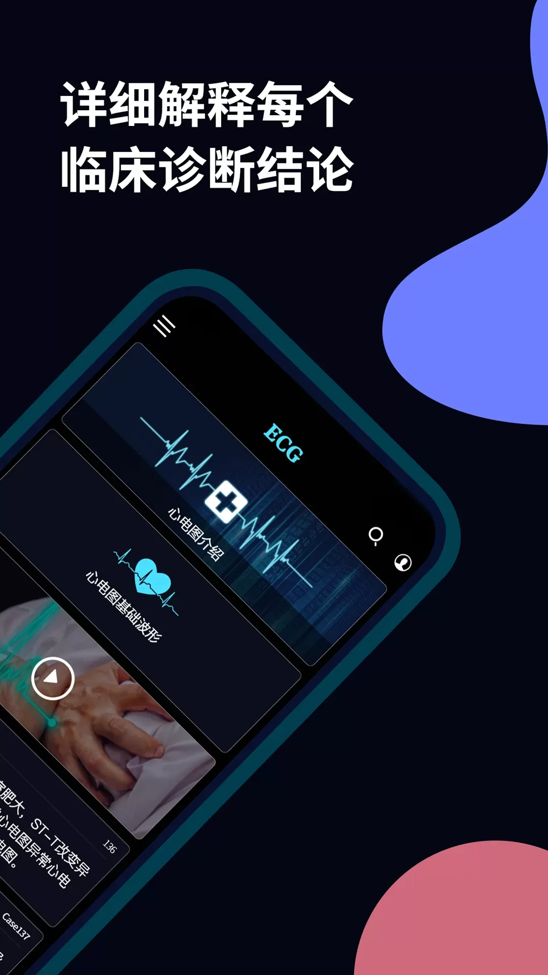 心电图ECG官网版手机版图1